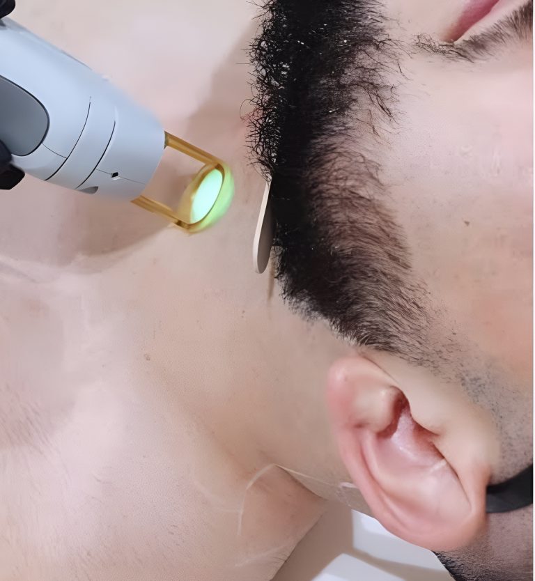 laser_2